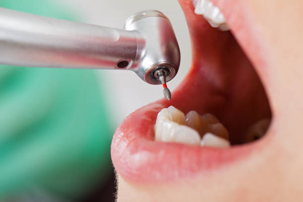 Fast & Reliable Emergency Dental Services in HI